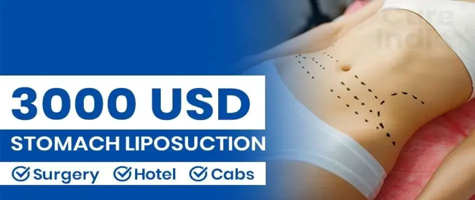 Stomach Liposuction Cost
